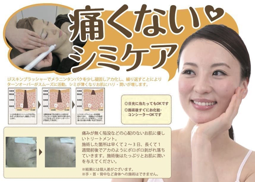 痛くないシミケア