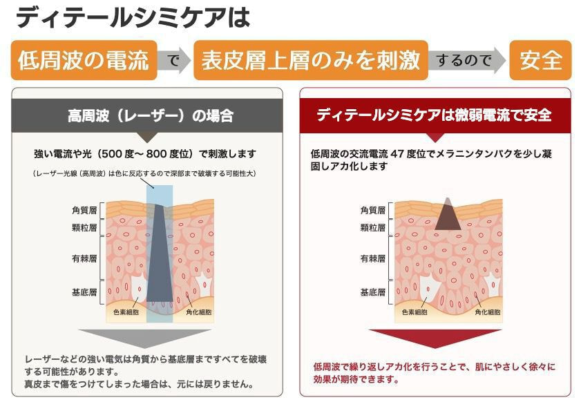 シミケア専門店ディテール