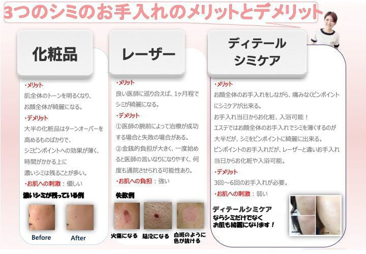 シミケア専門店ディテール