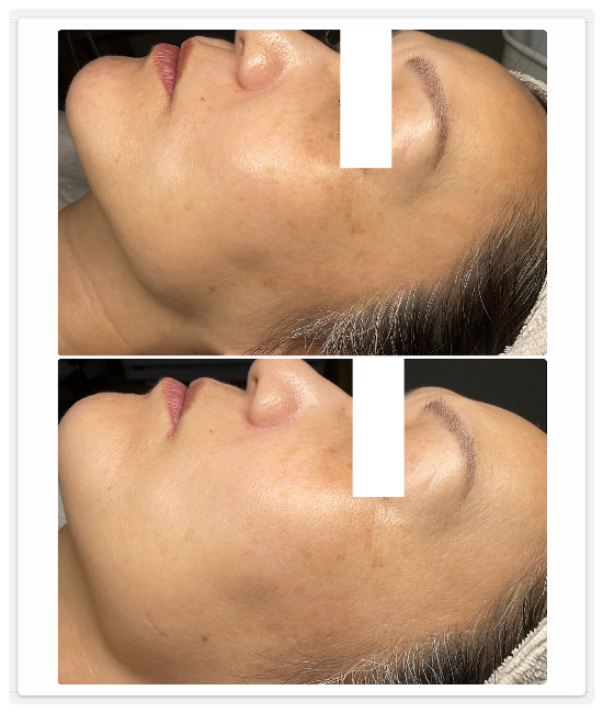 シミケア専門店ディテール