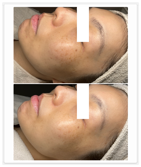 シミケア専門店ディテール