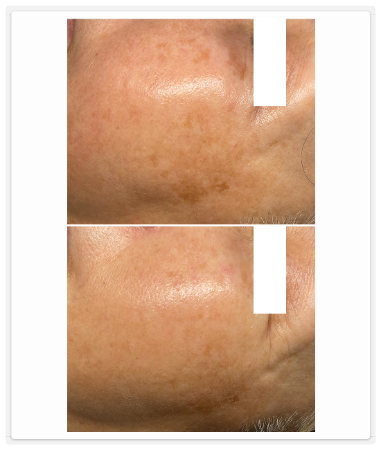 シミケア専門店ディテール