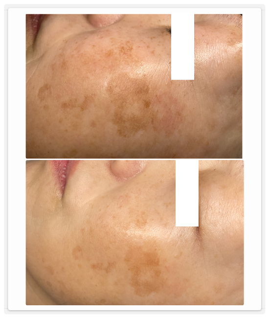 シミケア専門店ディテール