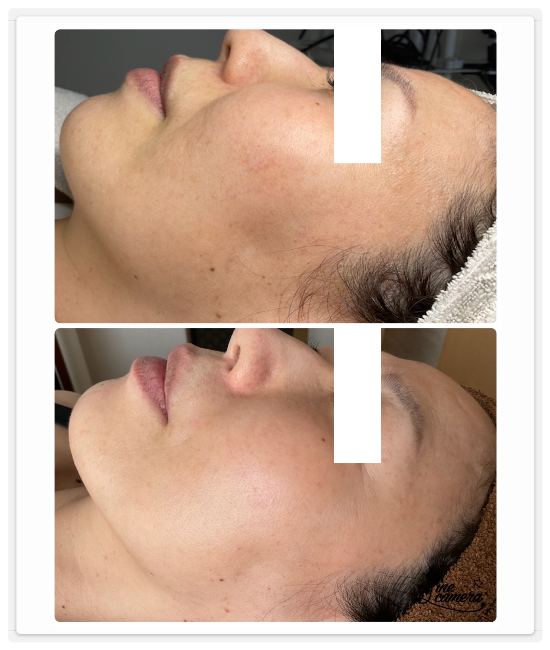 シミケア専門店ディテール