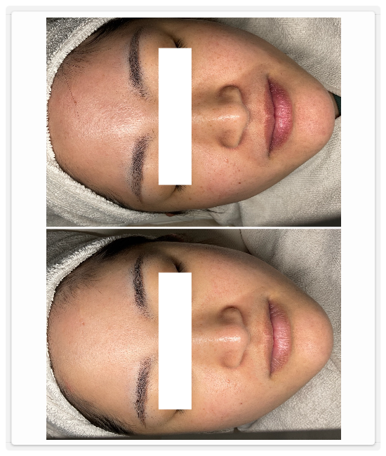 シミケア専門店ディテール