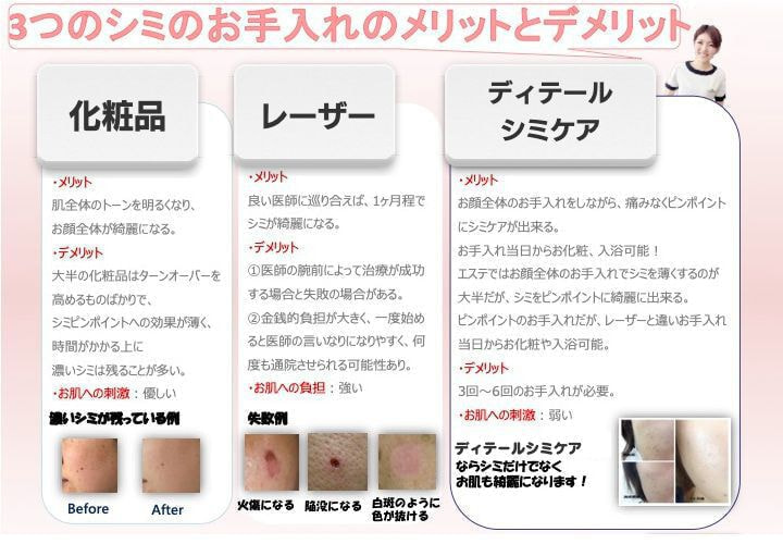 シミケア専門店ディテール